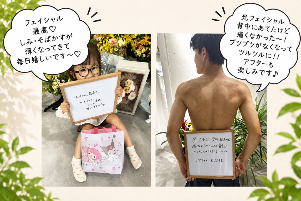 お客様の声：フェイシャル・光フォト